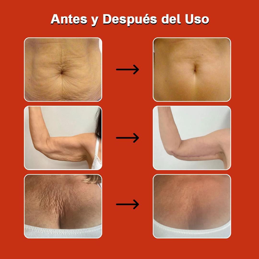 Aceite Mágico Anticelulitis 100 ml