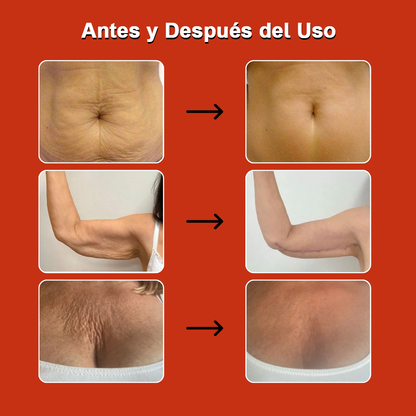 Aceite Mágico Anticelulitis 100 ml