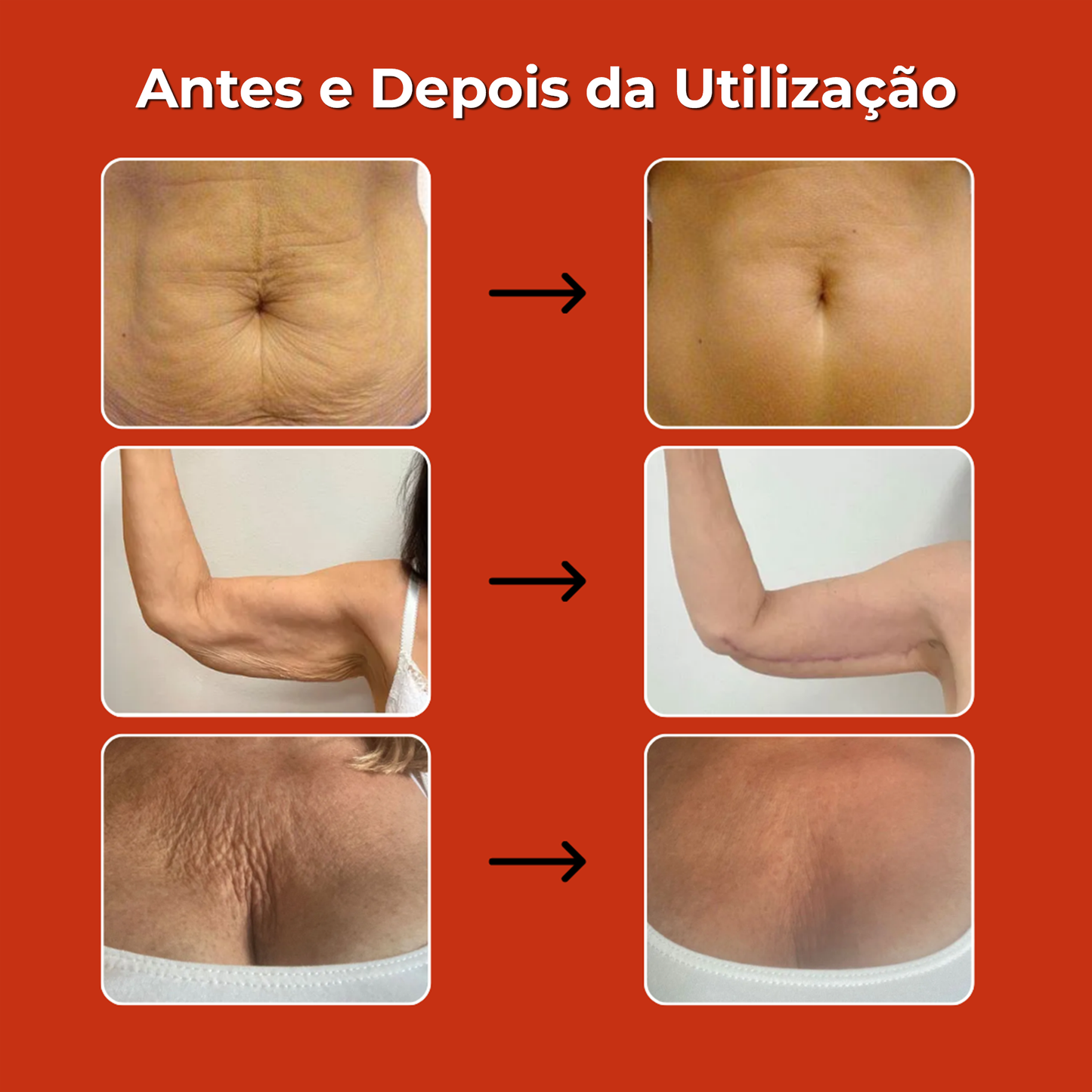 Compra 2 y llévate 2 Aceite Mágico Anticelulitis 100ml